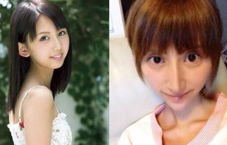 盘点整容失败的女星