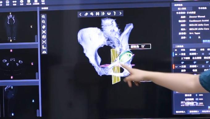 看人工智能如何實現精準醫療